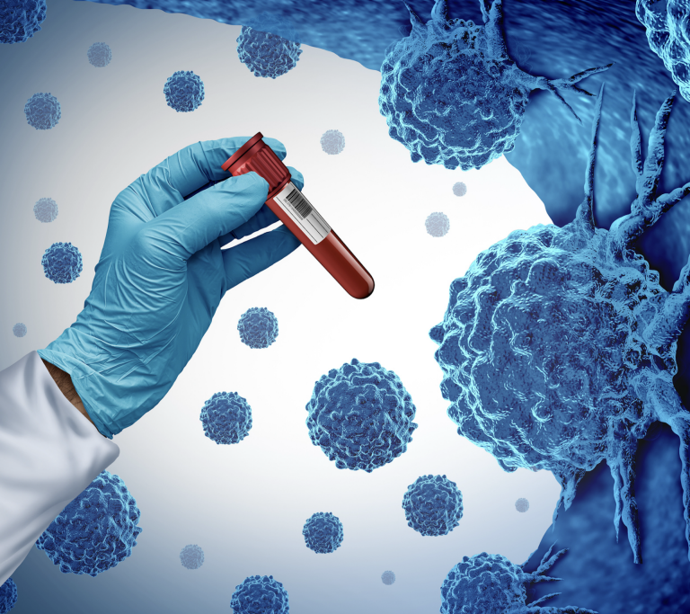 New Blood Test Can Detect Even One Cancer Cell