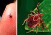 Andhra’s Deadly Scrub Typhus Surge Exposed Scrub Typhus Scare 2,000+ Cases, 22 Deaths